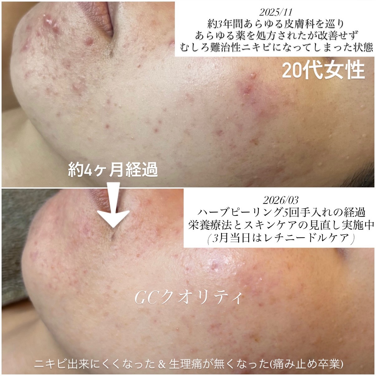 ビフォーアフター
