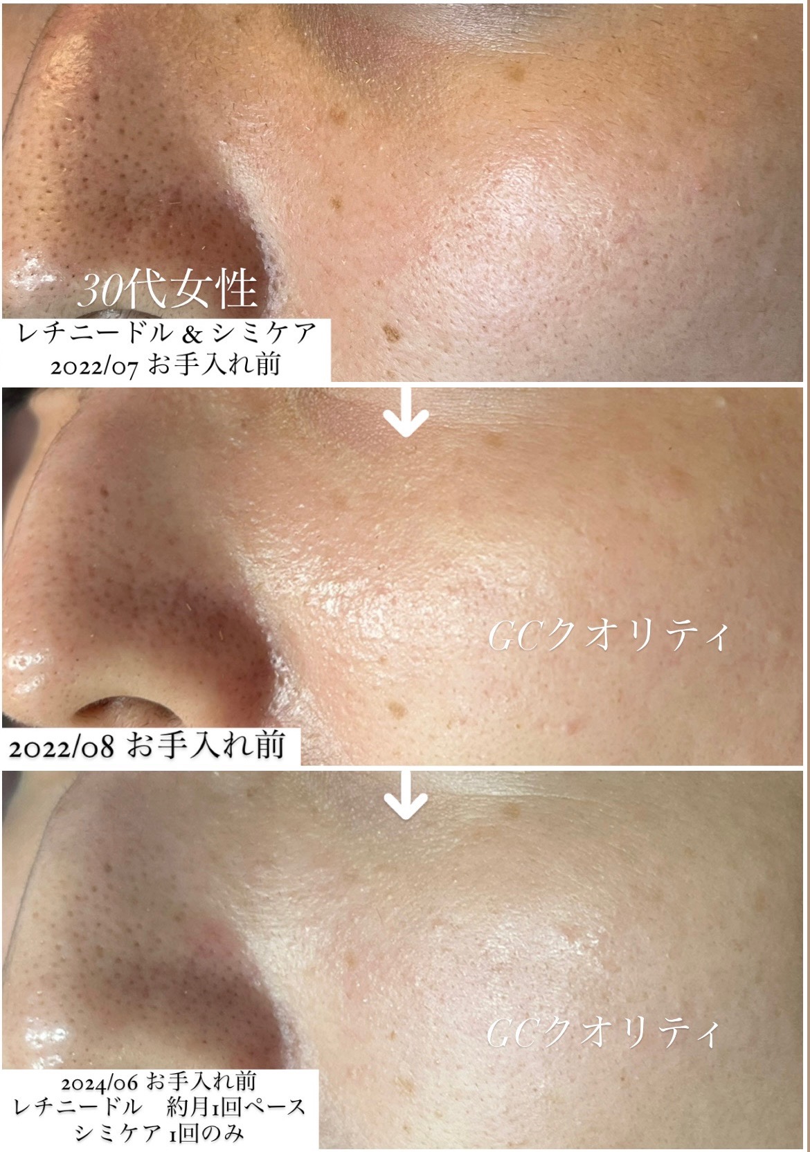 ビフォーアフター