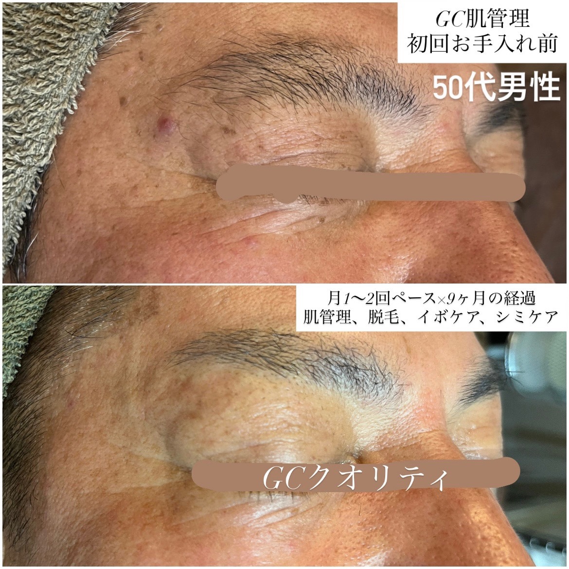 ビフォーアフター